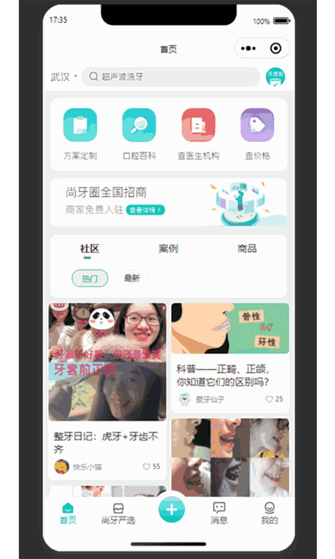 尚牙圈